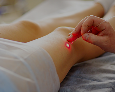 VC_LaserTreatment