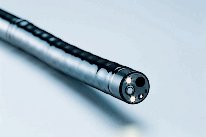 Колоноскопия